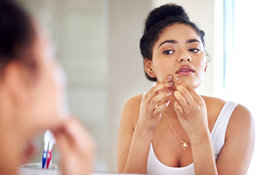 What is hormonal acne and how can a skincare routine help